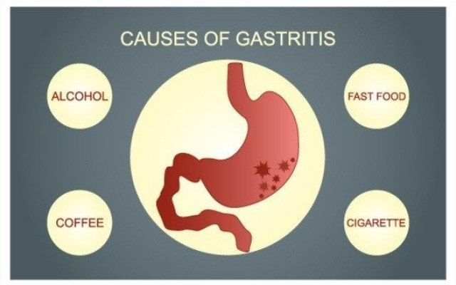 Najbolja hrana za gastritis i gorušicu - koju hranu jesti kod želudačne kiseline