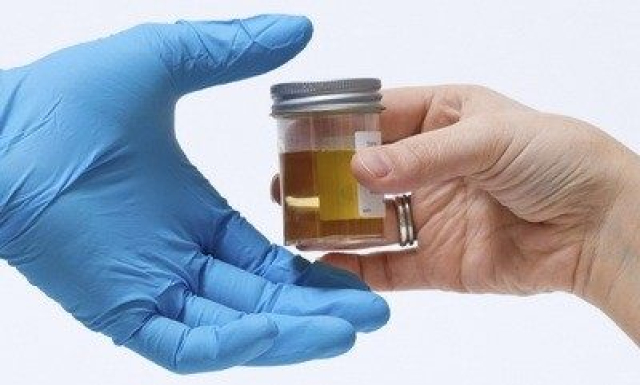 test urina za hipertenziju