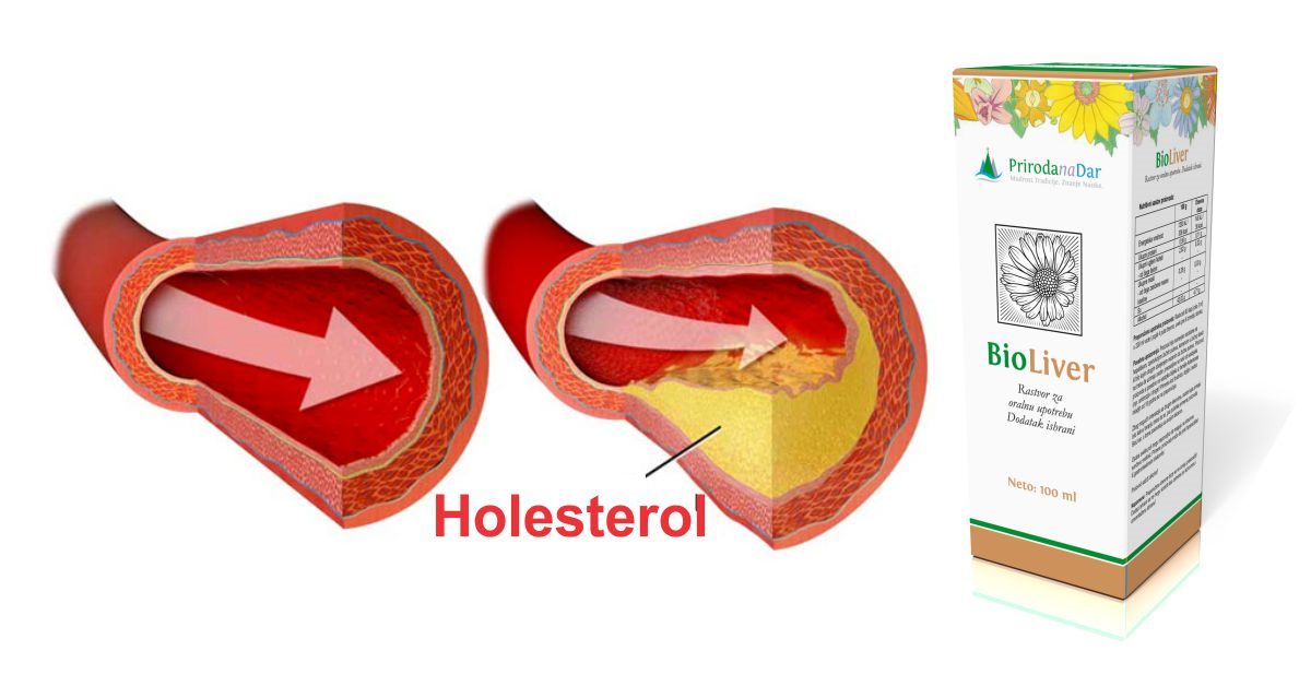 Visok holesterol i ishrana - kako se hraniti kod visokog holesterola