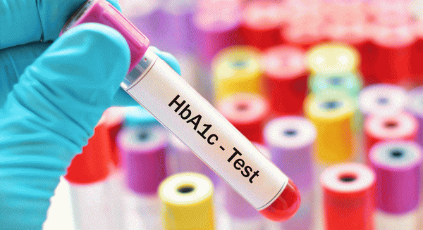 Šta je HbA1c krvni parametar - glikozilirani hemogolobin
