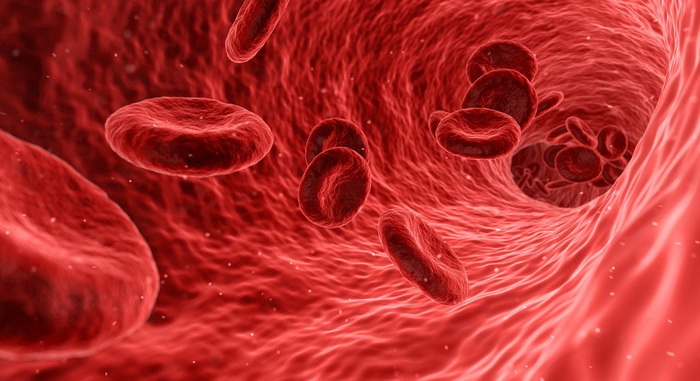 Krvni plak na arterijama kako nastaje i zašto je opasan?