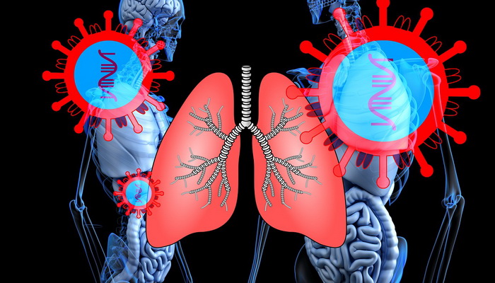 Upala pluća ishrana koja može da Vam pomogne da se rešite tegoba